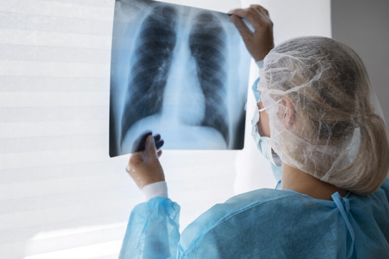 x-ray in indore