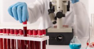 pathology lab in indore